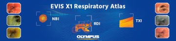 EVIS X1 Respiratory Atlas